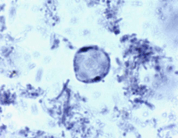 Image: The anaerobic intestinal protozoan Blastocystis hominis (Photo courtesy of K-State).